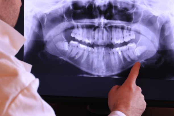 Best Emergency Dental Care for Broken or Chipped Teeth in Tieton, WA